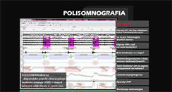 Desktop Screenshot of polisomnografia.com.pl